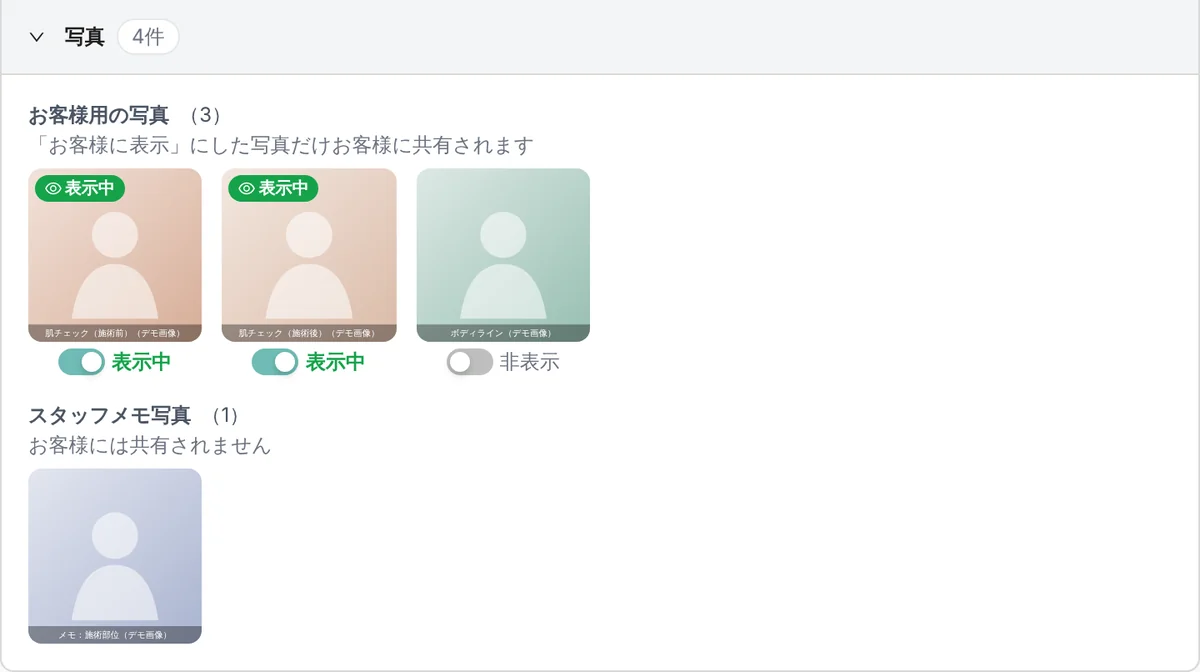管理画面のカルテの写真の欄。お客様用の写真 3 枚（肌チェックの施術前・施術後、ボディライン）のうち 2 枚が「表示中」、1 枚が「非表示」で、その下にお客様には共有されないスタッフメモ写真が 1 枚ある（表示はデモデータ。写真はデモ用の画像）
