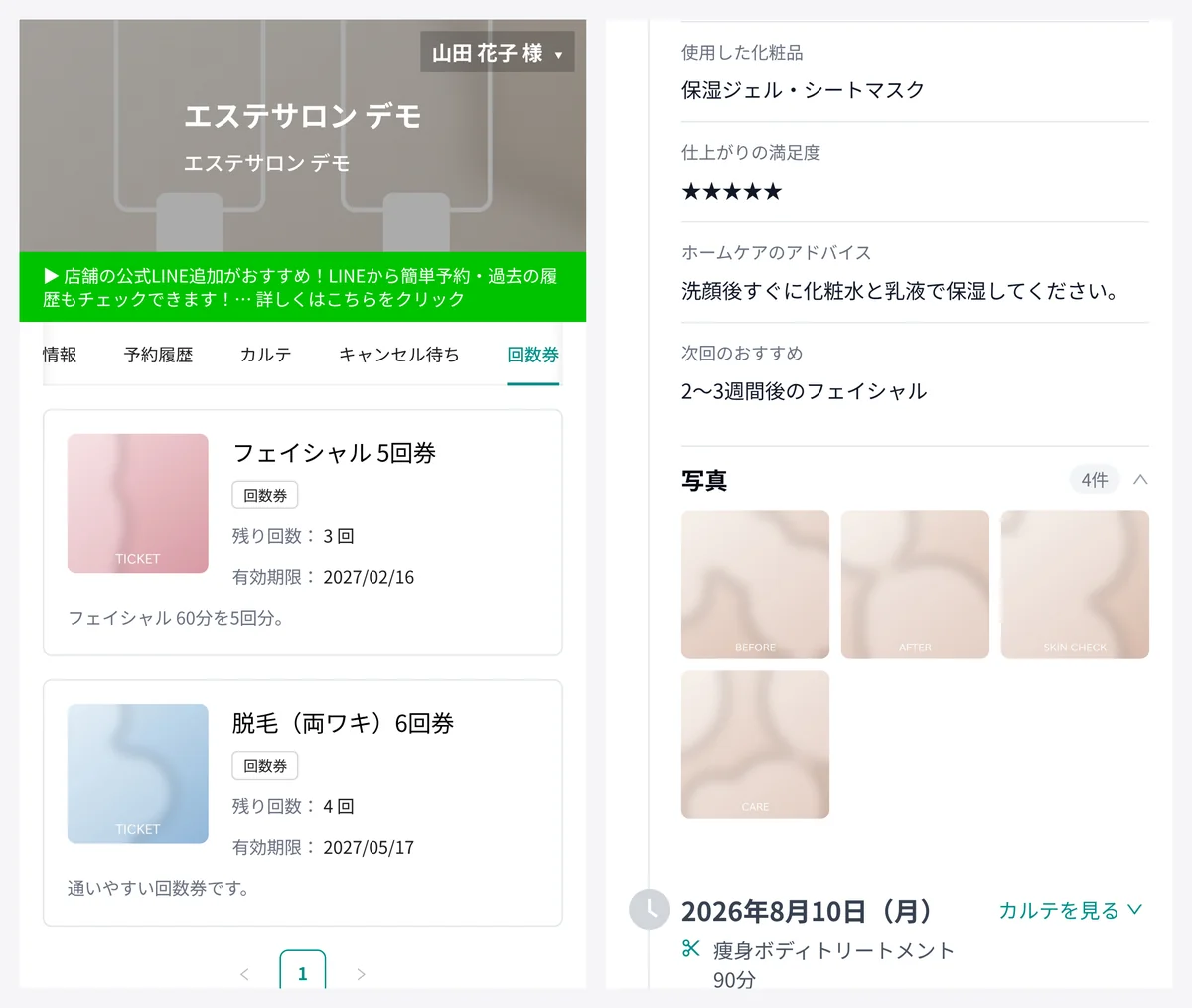 お客様の画面。左は回数券の一覧で、フェイシャル 5回券（残り 3 回）と脱毛（両ワキ）6回券（残り 4 回）の残り回数と有効期限。右はカルテで、使用した化粧品・仕上がりの満足度・ホームケアのアドバイス・次回のおすすめと、施術の写真 4 枚（表示はデモデータ。写真はデモ用の抽象的な画像）
