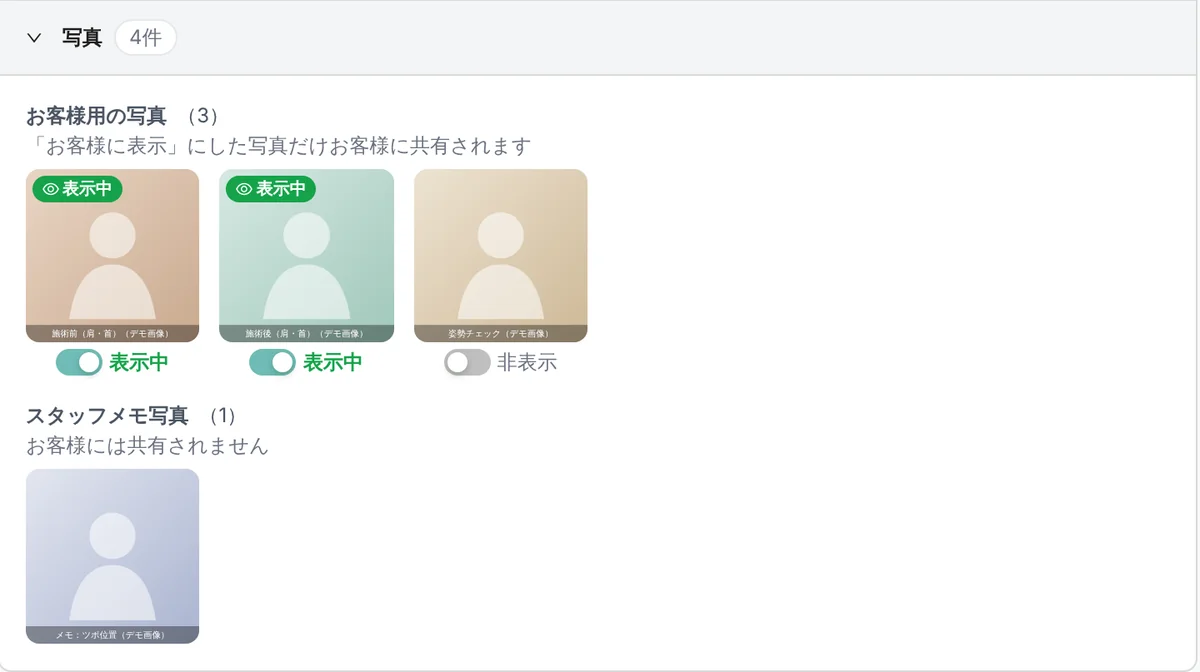 管理画面のカルテの写真の欄。お客様用の写真 3 枚（施術前・施術後・姿勢チェック）のうち 2 枚が「表示中」、1 枚が「非表示」。その下に「お客様には共有されません」と書かれたスタッフメモ写真が 1 枚ある（表示はデモデータ。写真はデモ用の画像）