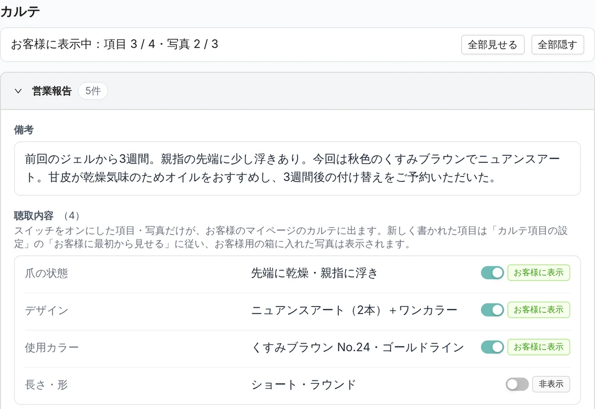 管理画面のカルテの営業報告。備考の文と、聴取内容 4 項目（爪の状態、デザイン、使用カラー、長さ・形）。3 項目が「お客様に表示」、長さ・形が「非表示」になっている（表示はデモデータ）
