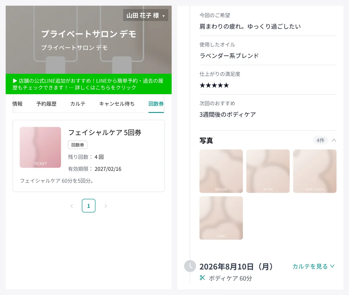 お客様の画面。左は回数券の一覧で、フェイシャルケア 5回券の残り回数（4 回）と有効期限。右はカルテで、今回のご希望・使用したオイル・仕上がりの満足度・次回のおすすめと、施術の写真 4 枚（表示はデモデータ。写真はデモ用の抽象的な画像）